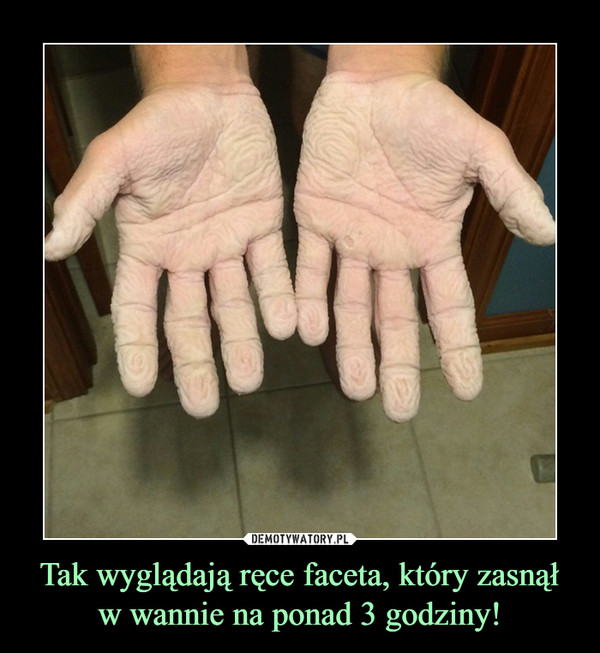 Tak wyglądają ręce faceta, który zasnął w wannie na ponad 3 godziny! –  