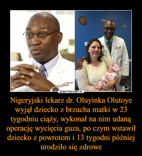 Nigeryjski lekarz dr. Oluyinka Olutoye wyjął dziecko z brzucha matki w 23 tygodniu ciąży, wykonał na nim udaną operację wycięcia guza, po czym wstawił dziecko z powrotem i 13 tygodni później urodziło się zdrowe
