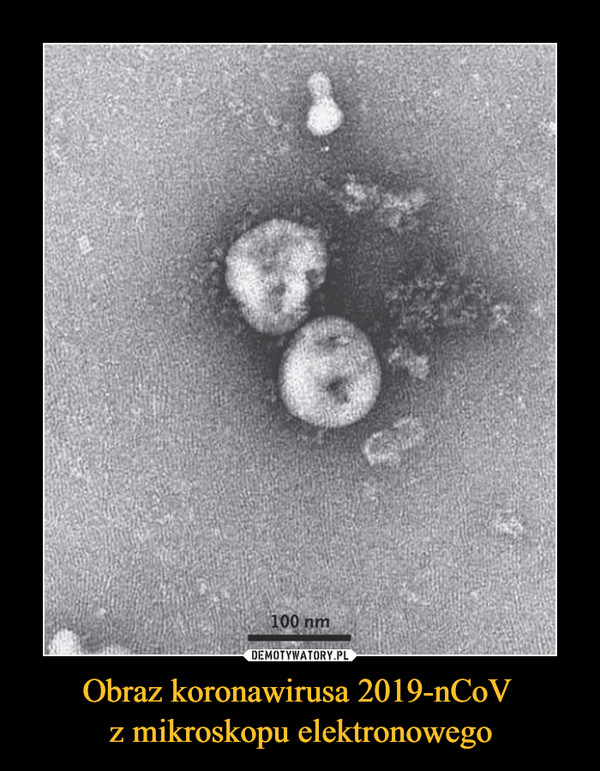 Obraz koronawirusa 2019-nCoV 
z mikroskopu elektronowego